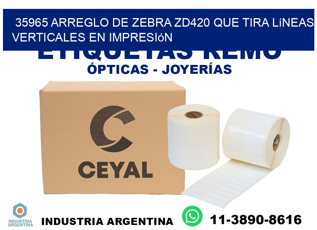 35965 arreglo de zebra zd420 que tira líneas verticales en impresión